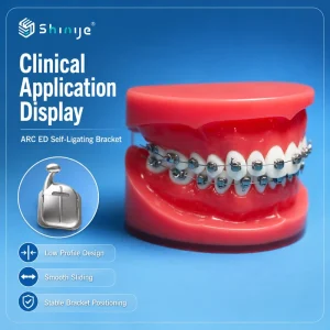 Orthodontic Bracket Low Profile Dental Braces Stable Locking Smooth Orthodontic System for Dental